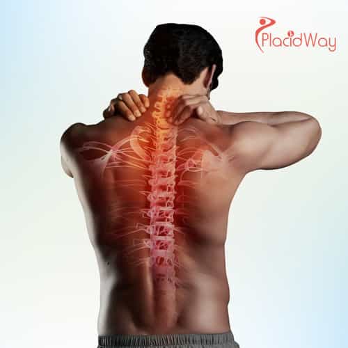 Células madre para lesiones de médula espinal en Cancún: Restaurando movilidad y función